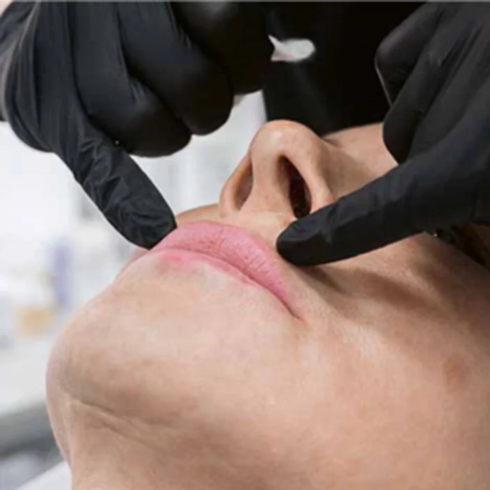 Удаление перманентного макияжа: подготовка биоревитализантом