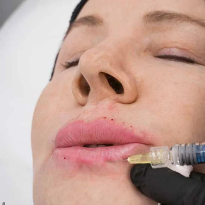 Удаление перманентного макияжа: подготовка биоревитализантом