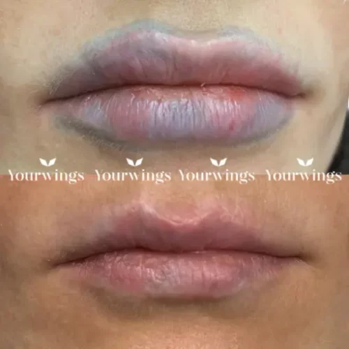Ремувер YOUR WINGS CLASSIC